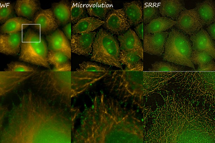 Visitron SRRF: Super Resolution Algorithm Module Software:Microscope