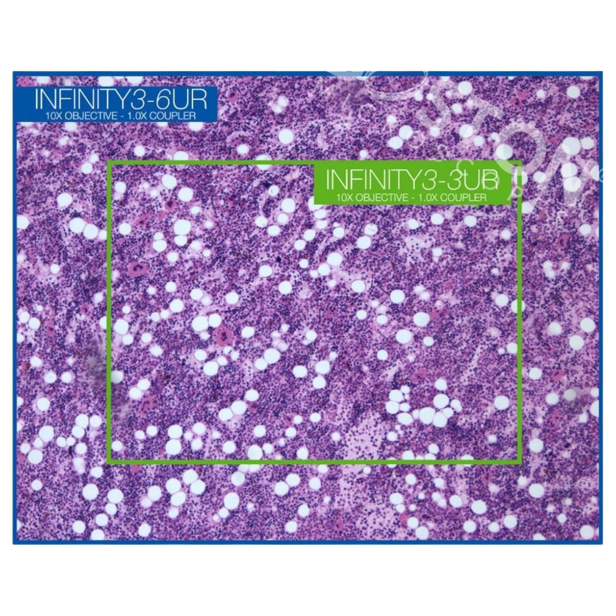 picture3_LUM-INF-3-6URC