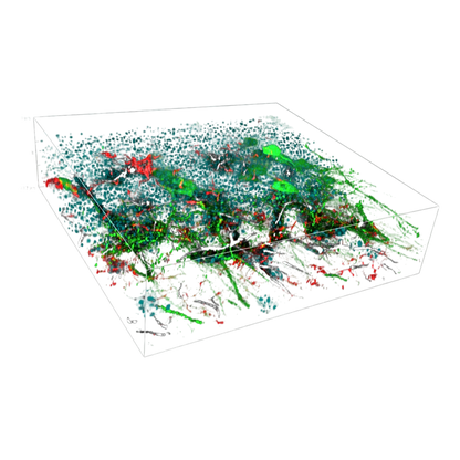 picture2_DeepSIMXlight