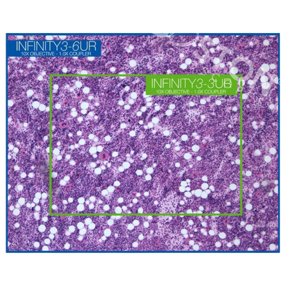 picture3_LUM-INF-3-6URC
